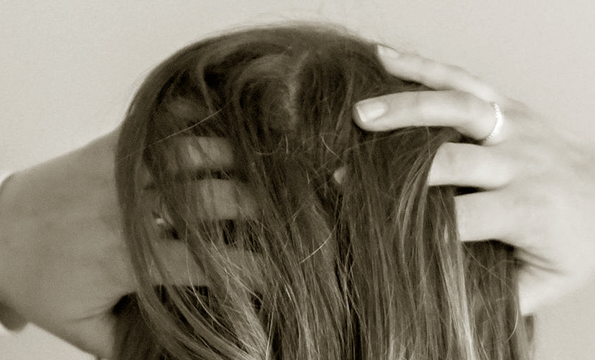 the scalp series no. 1 ~ dandruff